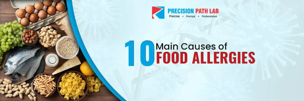 10 Most Common Causes of Food Allergies